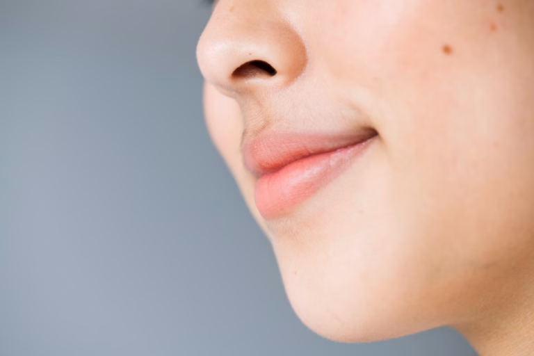 嘴唇外圍黑怎麼改善?