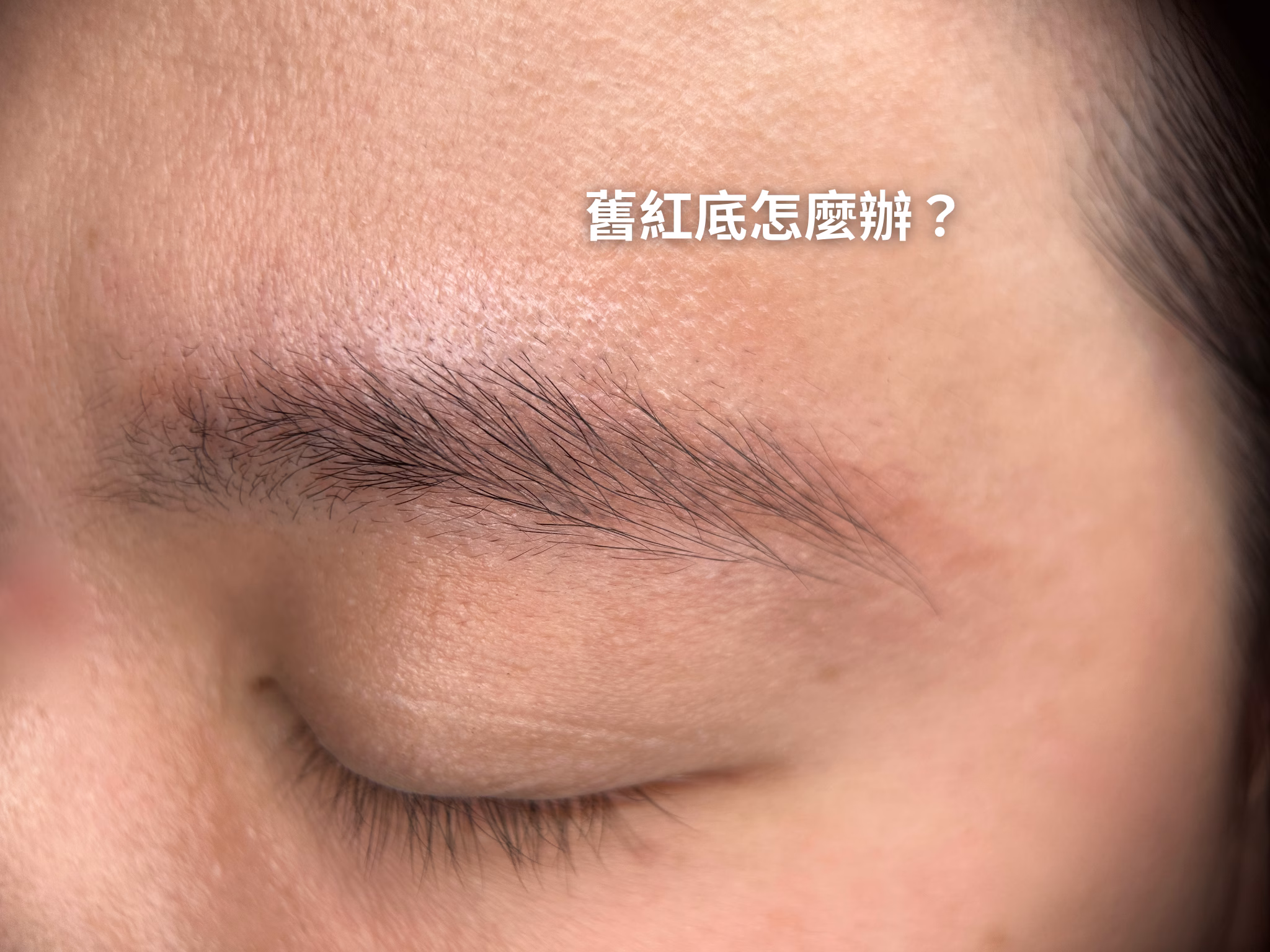 眉毛除色全攻略：無創、雷射、退色液怎麼選最安全